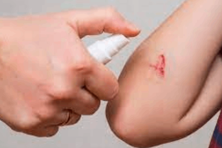 Wound Care